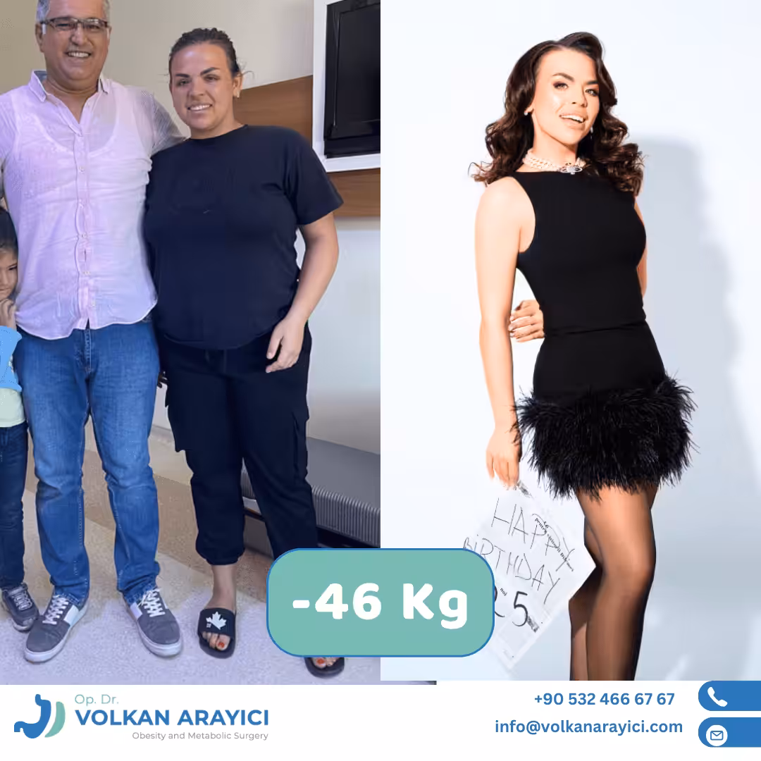 Bypass gástrico antes y después: paciente con 46 kg menos