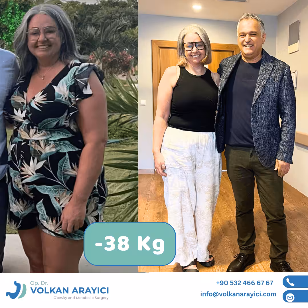 Manga gástrica Turquía antes y después: paciente con 38 kg menos junto al cirujano